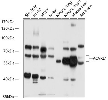 ACVRL1 Rabbit Polyclonal Antibody