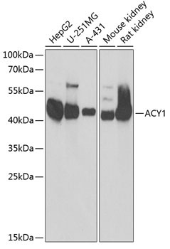 ACY1 Rabbit Polyclonal Antibody