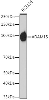 ADAM15 Rabbit Monoclonal Antibody