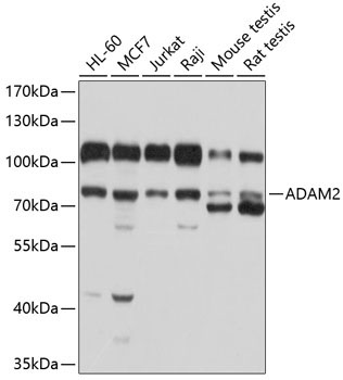 ADAM2 Rabbit Polyclonal Antibody