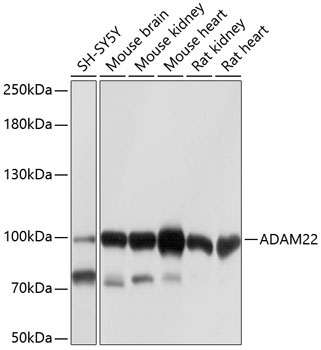 ADAM22 Rabbit Polyclonal Antibody