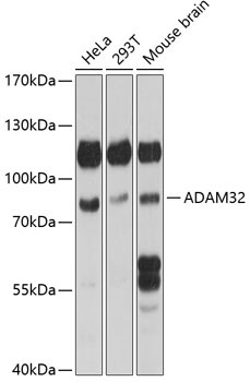 ADAM32 Rabbit Polyclonal Antibody