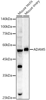 ADAM5 Rabbit Polyclonal Antibody
