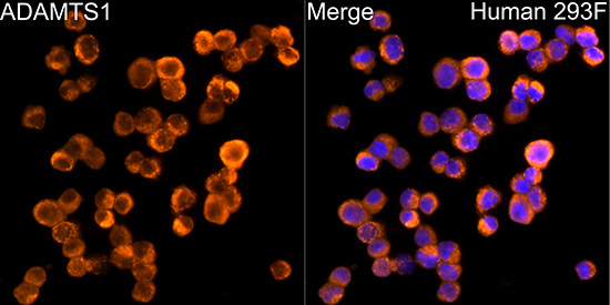 ADAMTS1 Rabbit Monoclonal Antibody