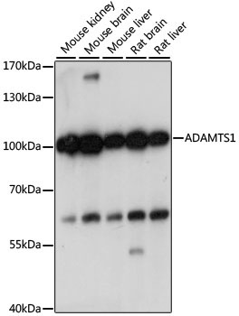 ADAMTS1 Rabbit Polyclonal Antibody