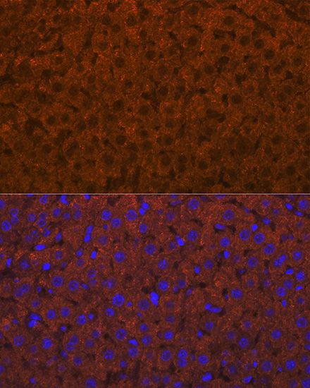 ADAMTS13 Rabbit Monoclonal Antibody