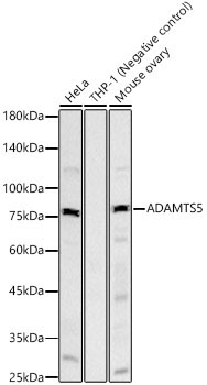 ADAMTS5 Rabbit Monoclonal Antibody