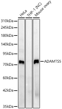 ADAMTS5 Rabbit Polyclonal Antibody