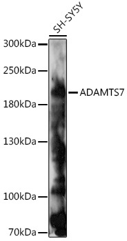 ADAMTS7 Rabbit Polyclonal Antibody