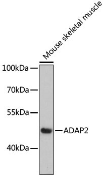 ADAP2 Rabbit Polyclonal Antibody