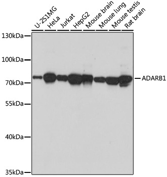 ADARB1 Rabbit Polyclonal Antibody