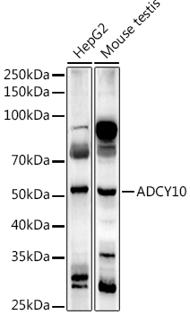 ADCY10 Rabbit Polyclonal Antibody