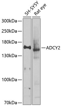 ADCY2 Rabbit Polyclonal Antibody