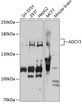 ADCY3 Rabbit Polyclonal Antibody