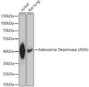 Adenosine Deaminase (ADA) Rabbit Polyclonal Antibody