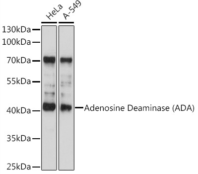 Adenosine Deaminase (ADA) Rabbit Polyclonal Antibody