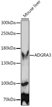 ADGRA3 Rabbit Polyclonal Antibody