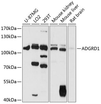 ADGRD1 Rabbit Polyclonal Antibody