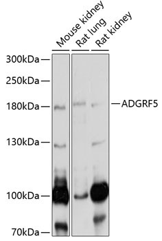 ADGRF5 Rabbit Polyclonal Antibody