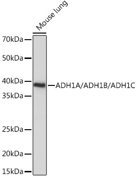 ADH1A/ADH1B/ADH1C Rabbit Polyclonal Antibody