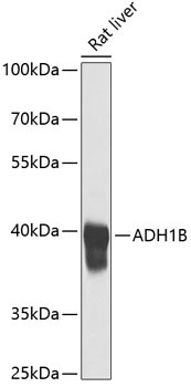 ADH1B Rabbit Polyclonal Antibody