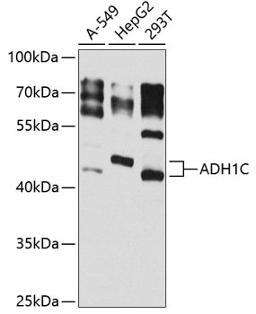 ADH1C Rabbit Polyclonal Antibody