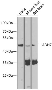 ADH7 Rabbit Polyclonal Antibody