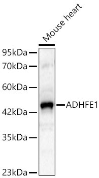 ADHFE1 Rabbit Polyclonal Antibody