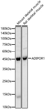 ADIPOR1 Rabbit Polyclonal Antibody