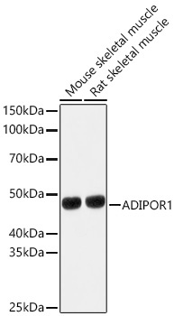 ADIPOR1 Rabbit Polyclonal Antibody