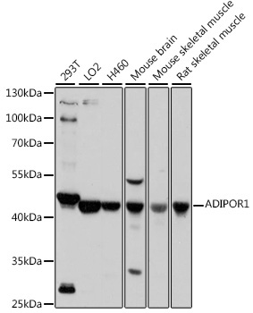 ADIPOR1 Rabbit Polyclonal Antibody