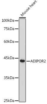ADIPOR2 Rabbit Polyclonal Antibody
