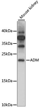 ADM Rabbit Polyclonal Antibody