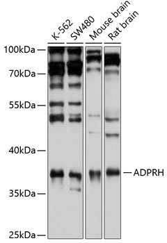 ADPRH Rabbit Polyclonal Antibody