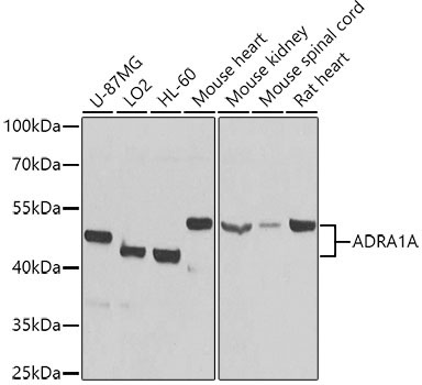 ADRA1A Rabbit Polyclonal Antibody