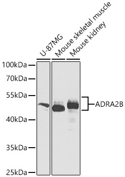 ADRA2B Rabbit Polyclonal Antibody