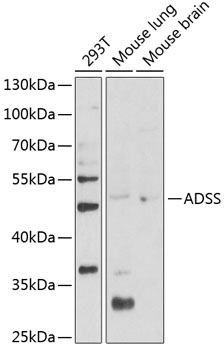 ADSS Rabbit Polyclonal Antibody