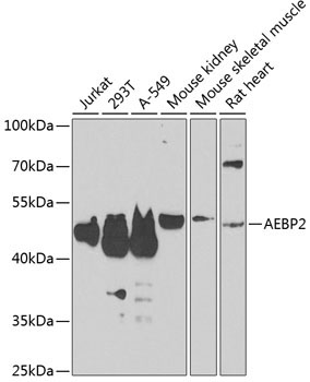 AEBP2 Rabbit Polyclonal Antibody