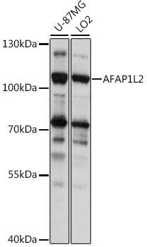 AFAP1L2 Rabbit Polyclonal Antibody