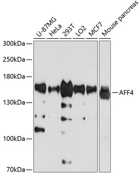 AFF4 Rabbit Polyclonal Antibody