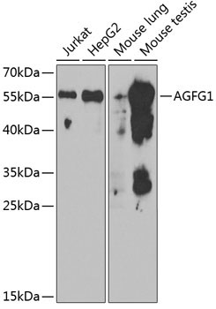 AGFG1 Rabbit Polyclonal Antibody