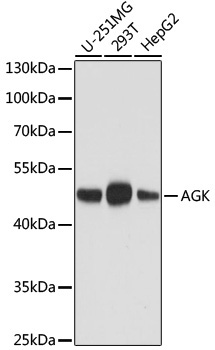 AGK Mouse Monoclonal Antibody