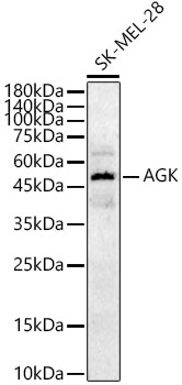 AGK Rabbit Polyclonal Antibody