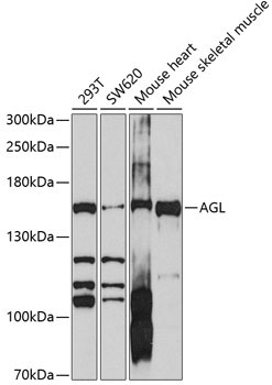 AGL Rabbit Polyclonal Antibody