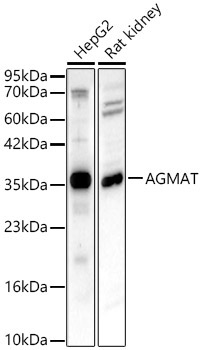 AGMAT Rabbit Polyclonal Antibody