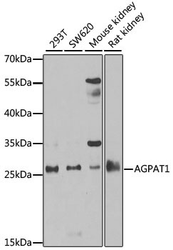 AGPAT1 Rabbit Polyclonal Antibody