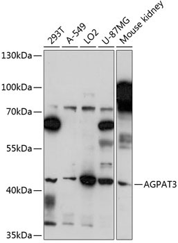 AGPAT3 Rabbit Polyclonal Antibody