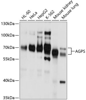AGPS Rabbit Polyclonal Antibody