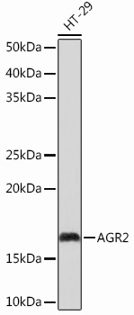 AGR2 Rabbit Monoclonal Antibody