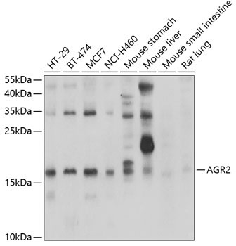 AGR2 Rabbit Polyclonal Antibody